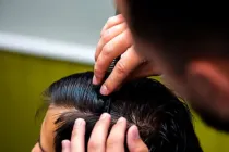 อัปเดต 2026 ! ปลูกไรผมราคาเท่าไหร่ ? เช็กที่นี่ที่เดียวจบ